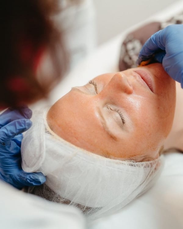 Chemical peel treatment application at Clinique en Beauté