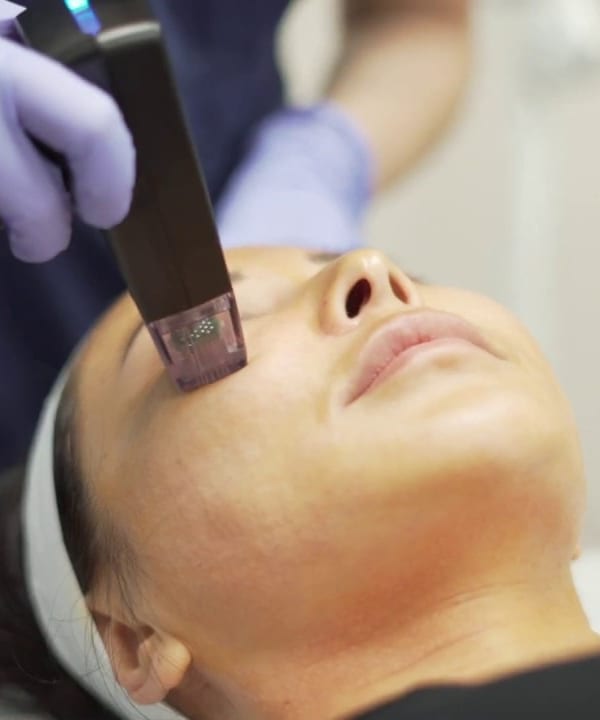 Microneedling collagen induction therapy at Clinique en Beauté